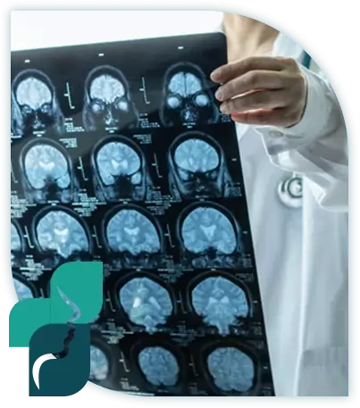 neurophysiologie