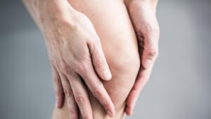 soigner l'arthrose du genou naturellement